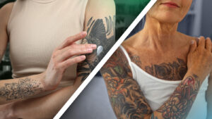 Alternde Tattoos: Was Sie Wissen Müssen